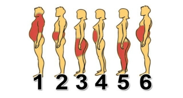 Top 5 Vị trí dễ tích mỡ trên cơ thể và cách giải quyết